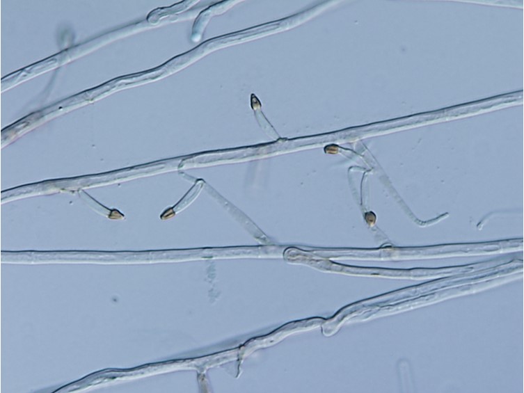 Ophiocordyceps brunneirubra